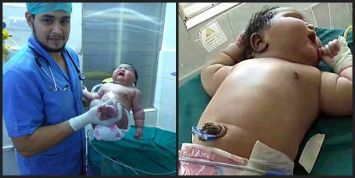 An Indian Woman Has Given Birth To The Heaviest Baby Girl In India Weighing Kg
