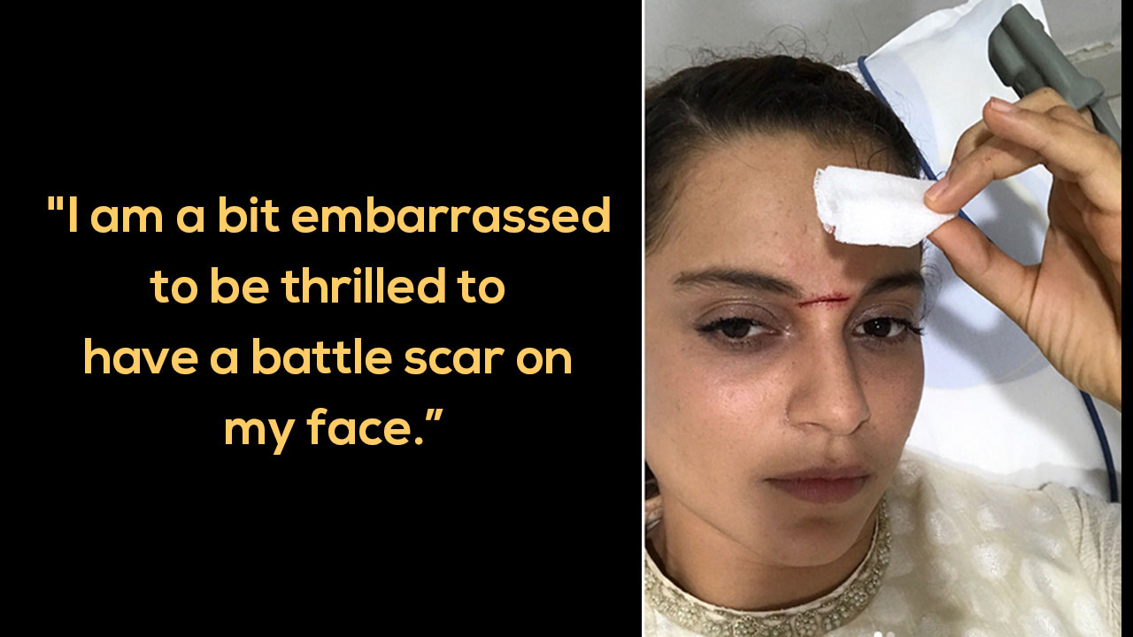 Kangana Ranaut Gets Injured With A Huge Scar On Her Face While Sword