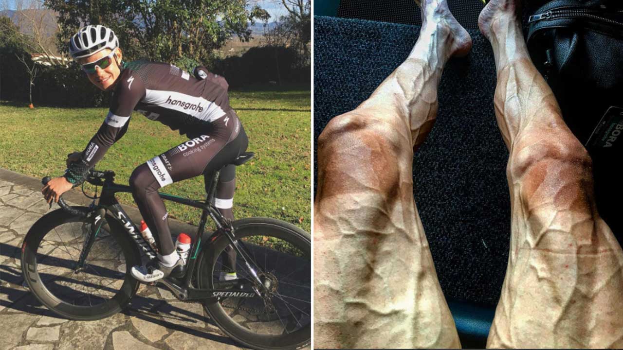 Cyclist Posts Pic Of His Legs After 16th Stage Of 'Tour De France' And