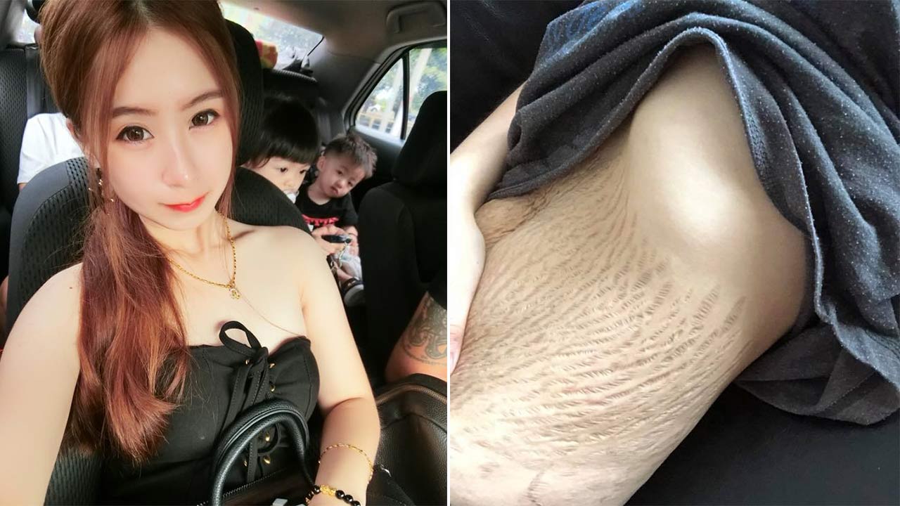 23-Year-Old Mom Responds to People Who Called Her Stretch Marks Ugly