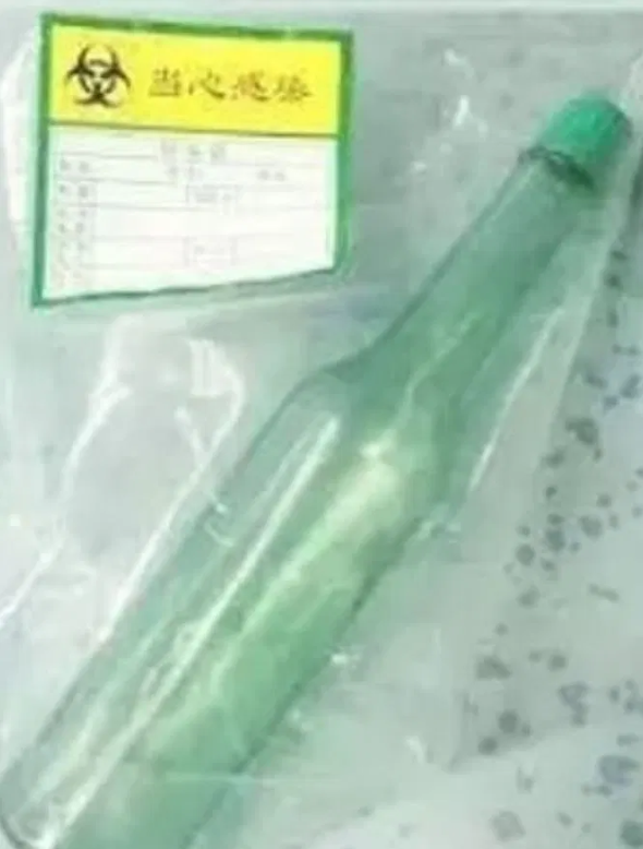 7 Inch Glass Bottle Surgically Removed From A Mans Rectum In China
