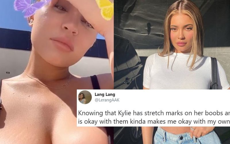 People Praise Kylie Jenner For Flaunting Stretch Marks On Her Breasts