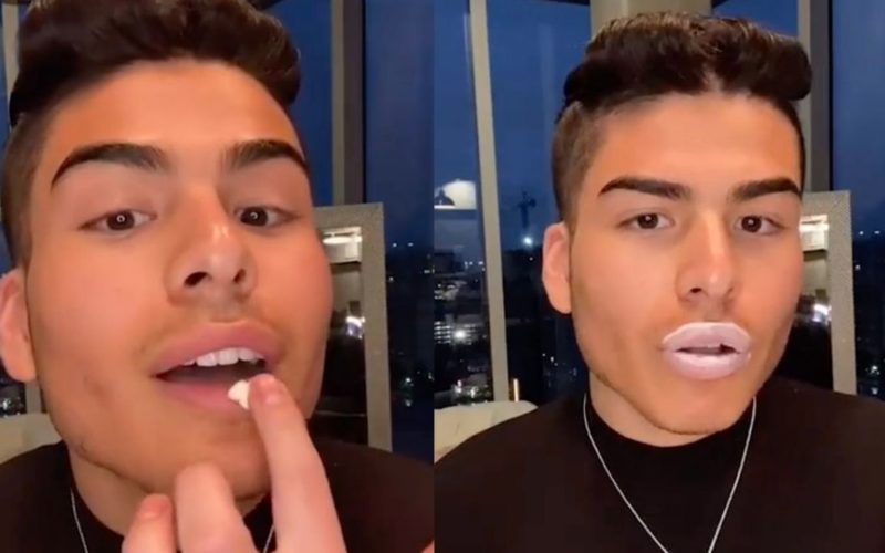 Man Uses Erection Cream For Plumped Up Lips, Doctors Warn Against It